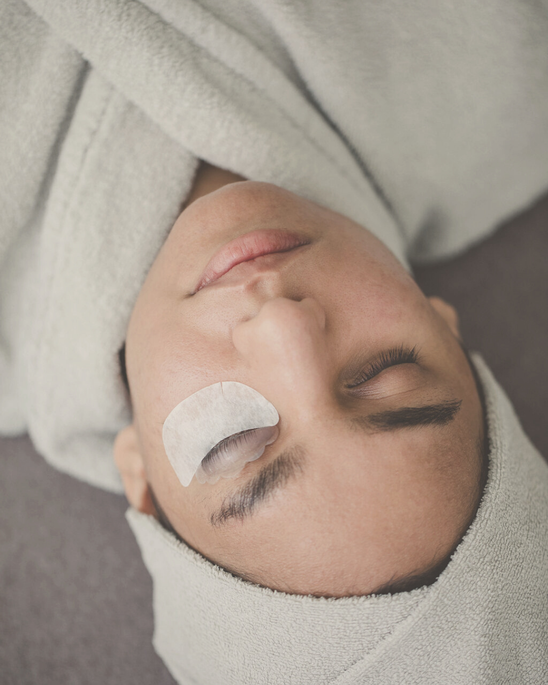 woman's face receiving a natural eyelash lifting