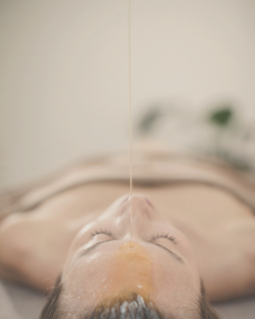 woman receiving Shirodhara - warm oil treatment for the head, warm herbal oil is being poured on her forehead